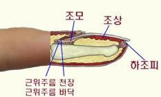 [건강정보] 손발톱 밑 검게 물들면 피부암 의심